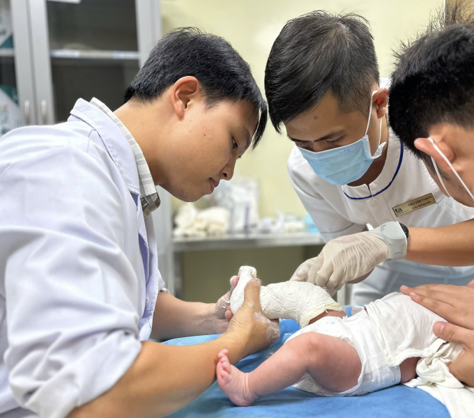 Bác sĩ bó bột chỉnh hình bàn chân khoèo cho bé Lộc. Ảnh: Bệnh viện cung cấp
